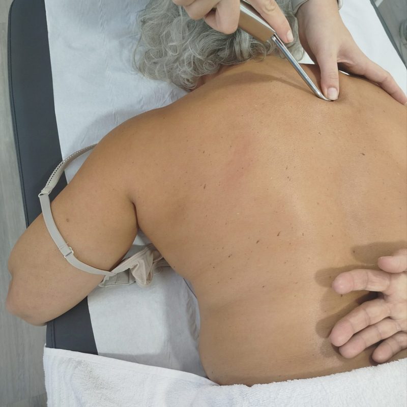Fibrolisis Diacutánea